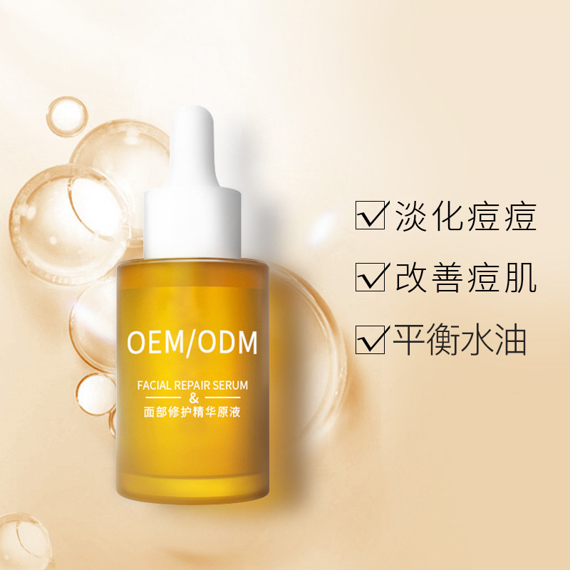 合川区_祛痘精华原液OEM